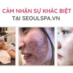 Trị Mụn Y Khoa